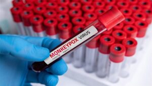 Doc-P-498389-638605139085117728-300x169 هل توجد مبرّرات كافية لإدخال لقاح "جدري القردة" إلى العراق؟