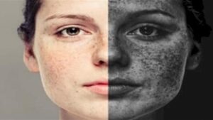 Doc-P-515319-638743334956738077-300x169 ما اضرار الأشعة فوق البنفسجية على البشرة؟